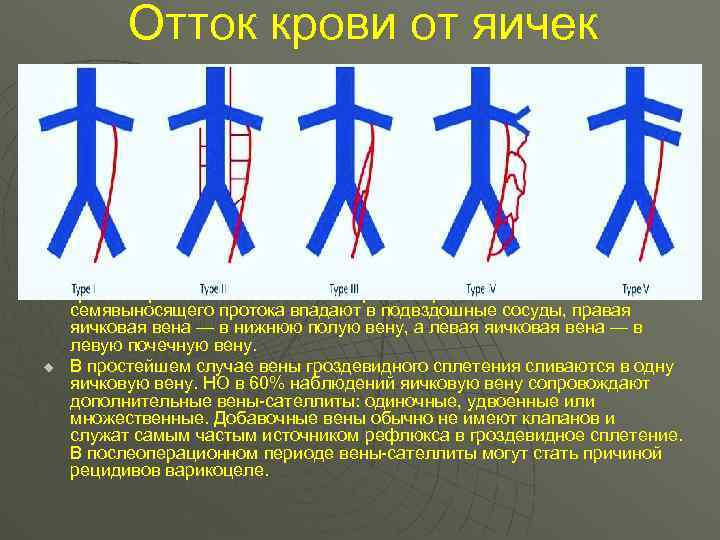 Отток крови от яичек u u В норме отток крови от яичка идет по