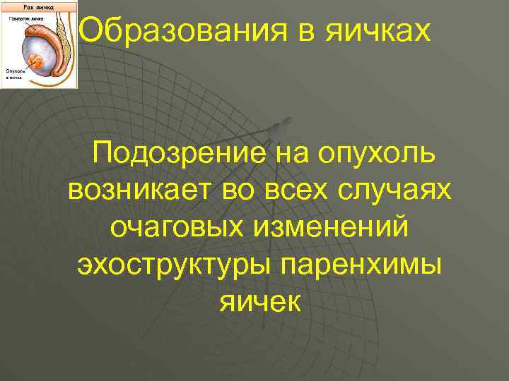 Образования в яичках Подозрение на опухоль возникает во всех случаях очаговых изменений эхоструктуры паренхимы