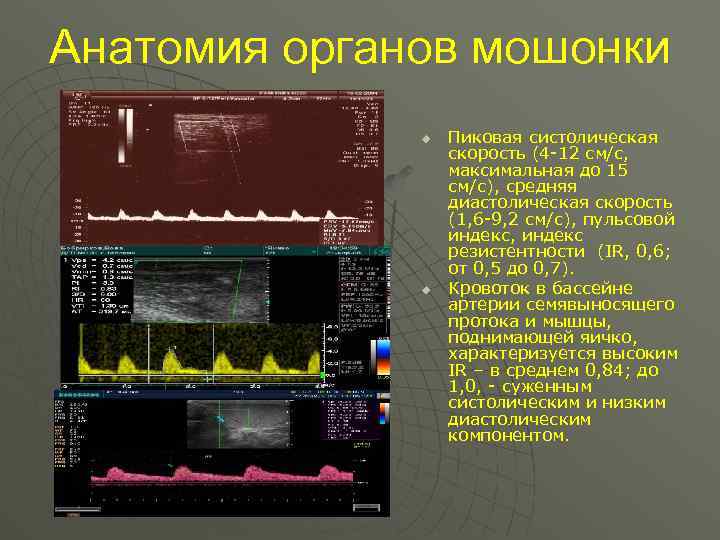 Анатомия органов мошонки u u Пиковая систолическая скорость (4 -12 см/с, максимальная до 15