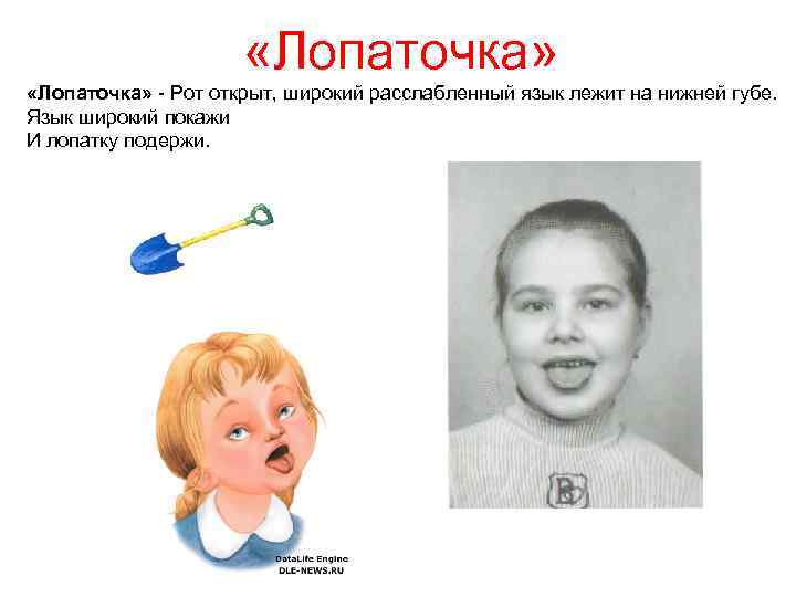  «Лопаточка» - Рот открыт, широкий расслабленный язык лежит на нижней губе. Язык широкий