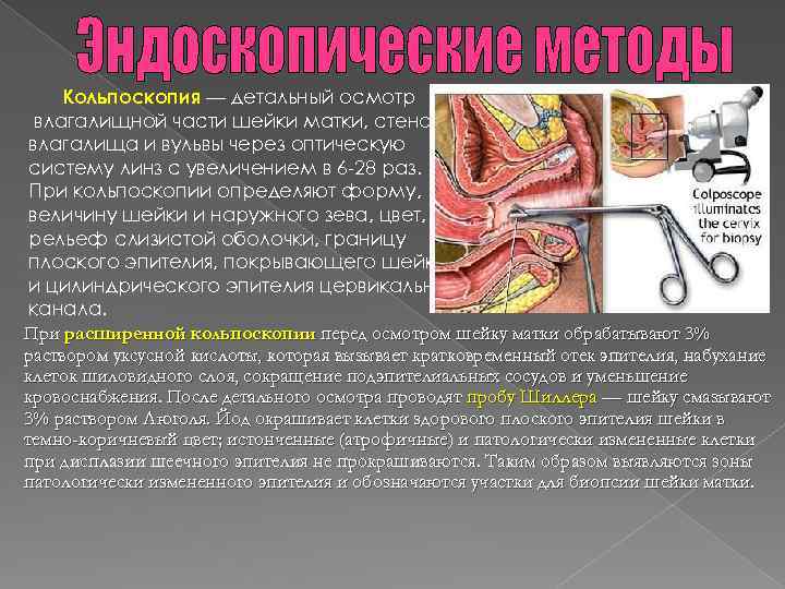 Кольпоскопия — детальный осмотр влагалищной части шейки матки, стенок влагалища и вульвы через оптическую