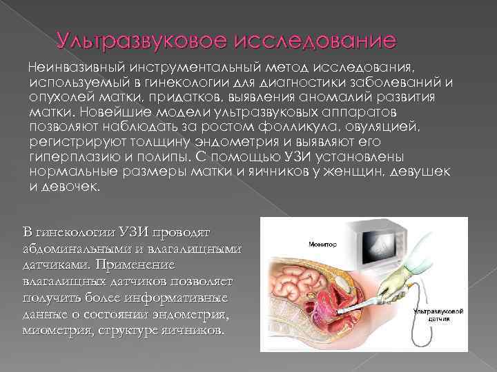 Ультразвуковое исследование Неинвазивный инструментальный метод исследования, используемый в гинекологии для диагностики заболеваний и опухолей
