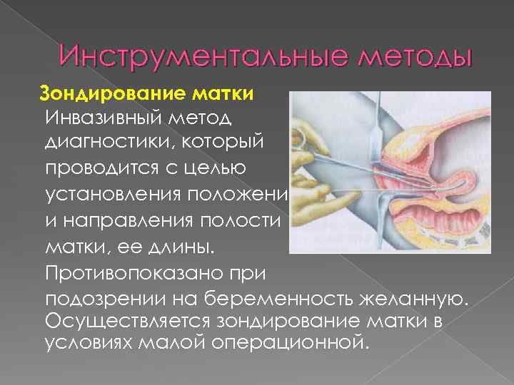 Инструментальные методы Зондирование матки Инвазивный метод диагностики, который проводится с целью установления положения и