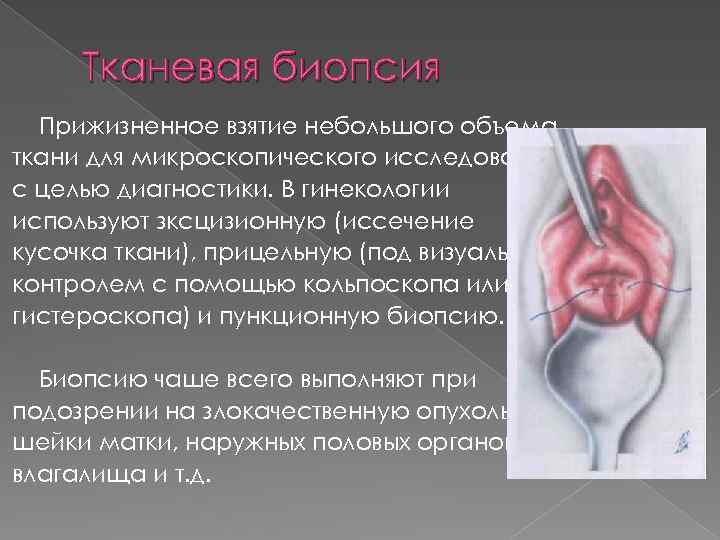 Тканевая биопсия Прижизненное взятие небольшого объема ткани для микроскопического исследования с целью диагностики. В