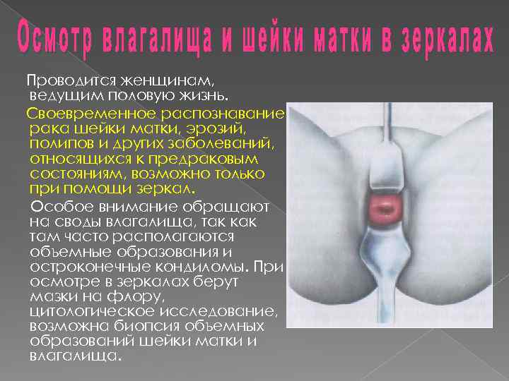Проводится женщинам, ведущим половую жизнь. Своевременное распознавание рака шейки матки, эрозий, полипов и других