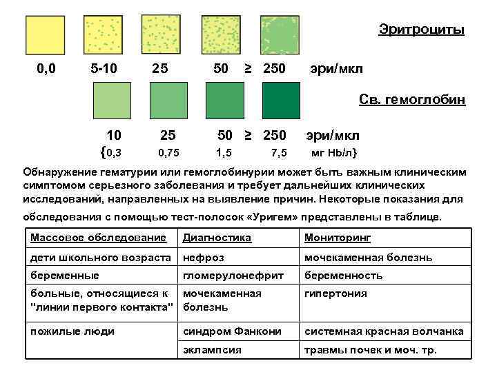 Эритроциты 0, 0 5 -10 25 50 ≥ 250 эри/мкл Св. гемоглобин 10 25