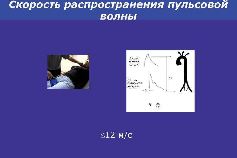 Скорость распространения пульсовой волны 12 м/с 