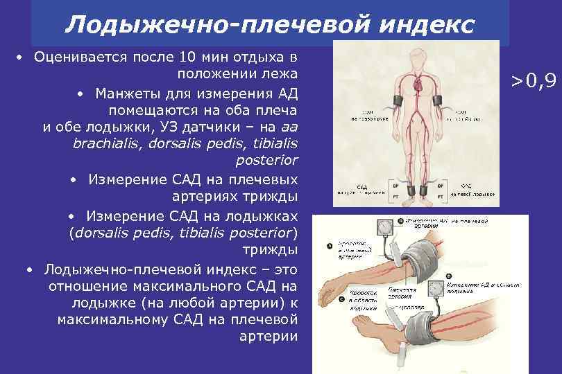 Лодыжечно-плечевой индекс • Оценивается после 10 мин отдыха в положении лежа • Манжеты для