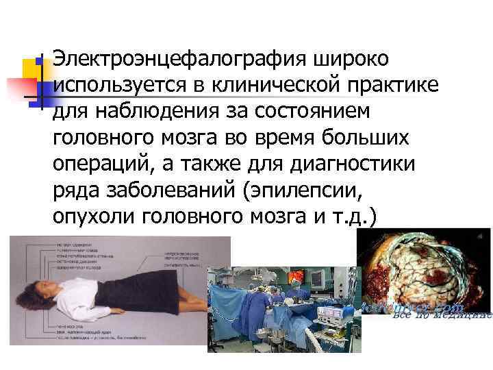 n Электроэнцефалография широко используется в клинической практике для наблюдения за состоянием головного мозга во