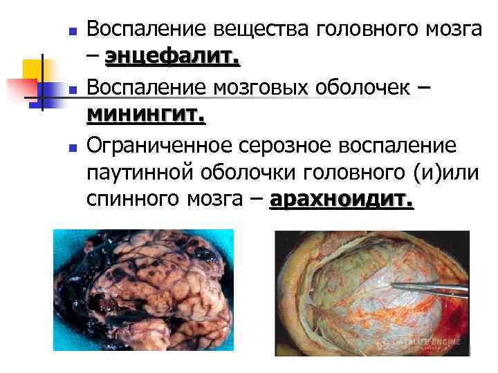 n n n Воспаление вещества головного мозга – энцефалит. Воспаление мозговых оболочек – минингит.