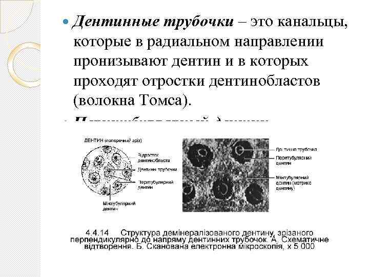  Дентинные трубочки – это канальцы, которые в радиальном направлении пронизывают дентин и в