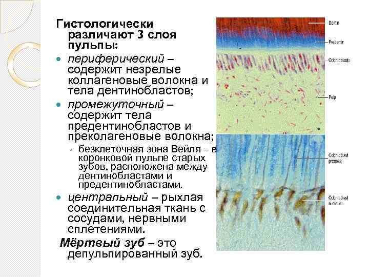 Гистологически различают 3 слоя пульпы: периферический – содержит незрелые коллагеновые волокна и тела дентинобластов;