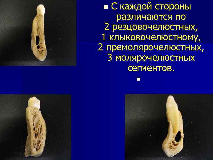 С каждой стороны различаются по 2 резцовочелюстных, 1 клыковочелюстному, 2 премолярочелюстных, 3 молярочелюстных сегментов.