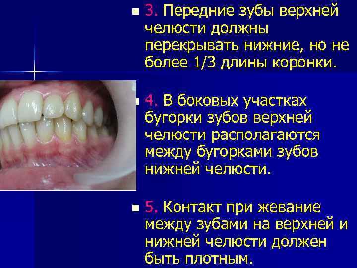 n 3. Передние зубы верхней челюсти должны перекрывать нижние, но не более 1/3 длины