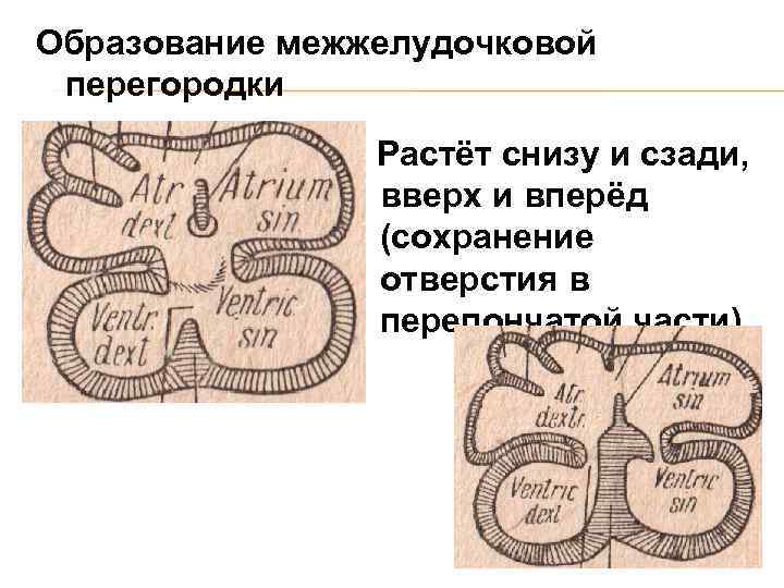 Образование межжелудочковой перегородки Растёт снизу и сзади, вверх и вперёд (сохранение отверстия в перепончатой