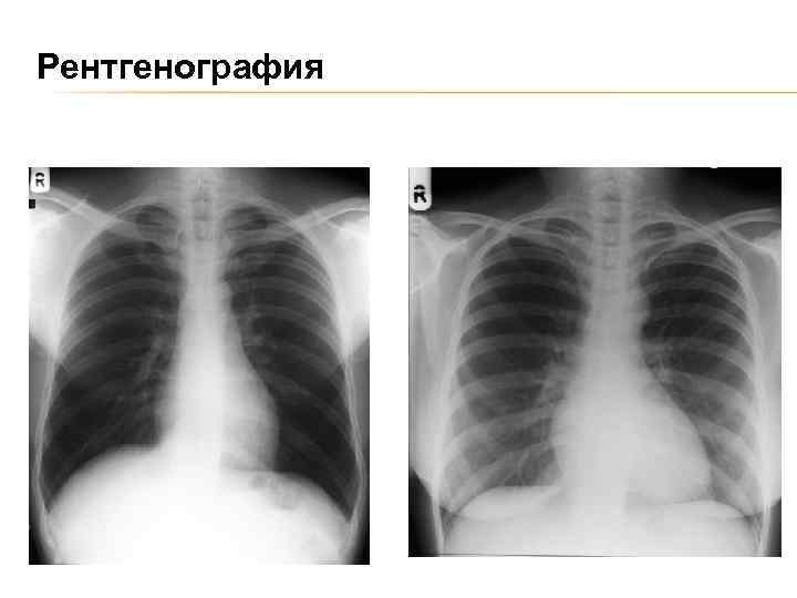 Рентгенография 