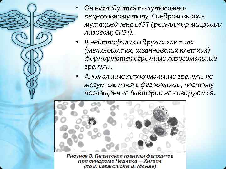  • Он наследуется по аутосомно рецессивному типу. Синдром вызван мутацией гена LYST (регулятор
