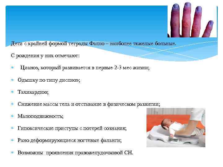 Дети с крайней формой тетрады Фалло – наиболее тяжелые больные. С рождения у них