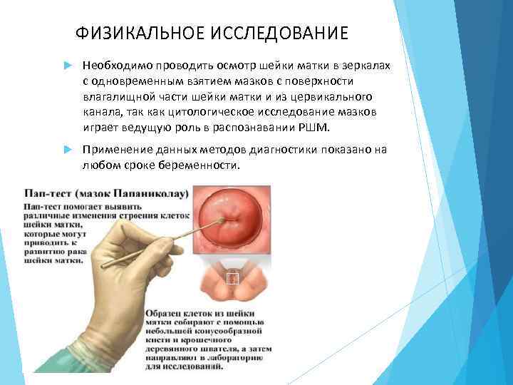 ФИЗИКАЛЬНОЕ ИССЛЕДОВАНИЕ Необходимо проводить осмотр шейки матки в зеркалах с одновременным взятием мазков с