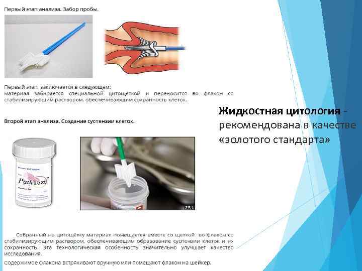 Жидкостная цитология - рекомендована в качестве «золотого стандарта» 