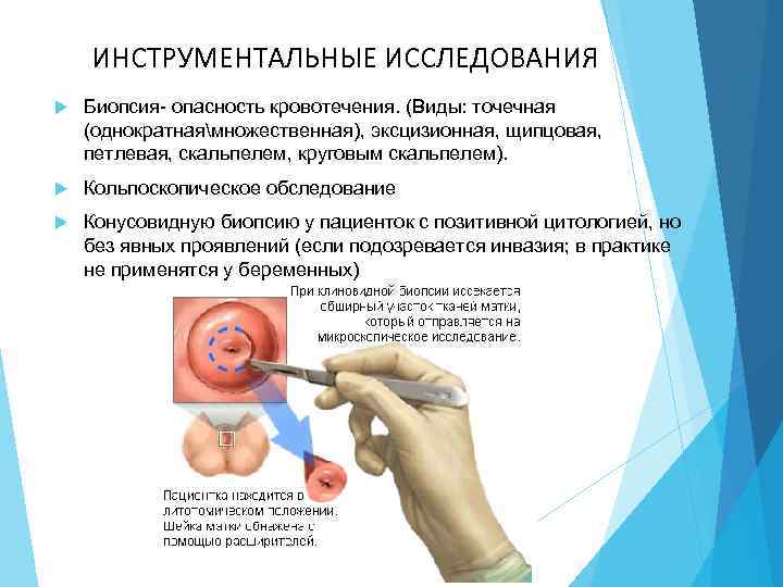 ИНСТРУМЕНТАЛЬНЫЕ ИССЛЕДОВАНИЯ Биопсия- опасность кровотечения. (Виды: точечная (однократнаямножественная), эксцизионная, щипцовая, петлевая, скальпелем, круговым скальпелем).