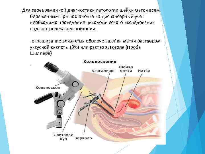 Для своевременной диагностики патологии шейки матки всем беременным при постановке на диспансерный учет необходимо