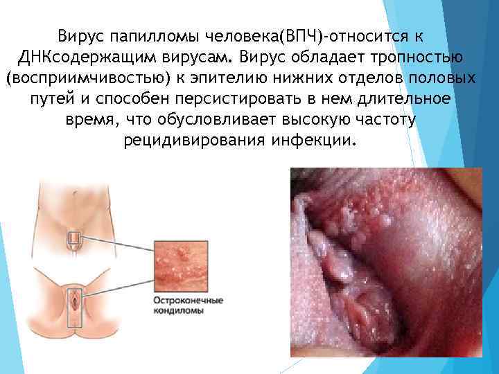 Вирус папилломы человека(ВПЧ)-относится к ДНКсодержащим вирусам. Вирус обладает тропностью (восприимчивостью) к эпителию нижних отделов