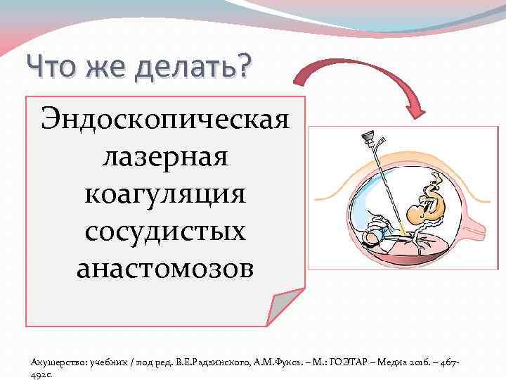 Что же делать? Эндоскопическая ? лазерная § Септостомия коагуляция § Селективная эвтаназия плода сосудистых