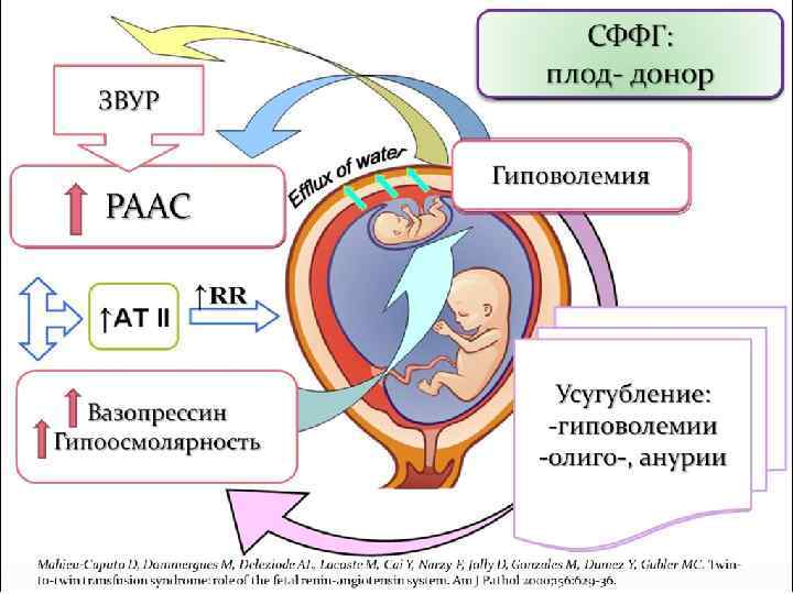 ЗВУР РААС Вазопрессин Гипоосмолярность СФФГ: плод- донор Гиповолемия Усугубление: -гиповолемии -олиго-, анурии Mahieu-Caputo D,