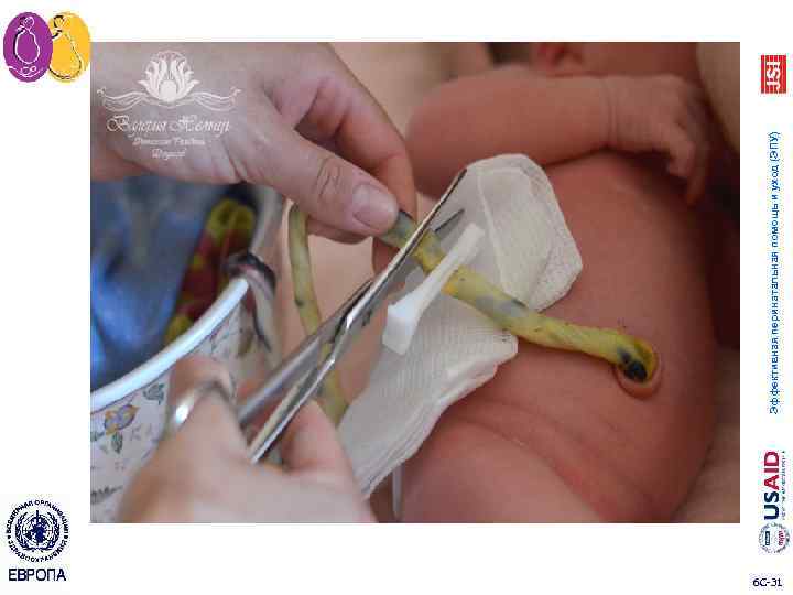 6 C 31 Эффективная перинатальная помощь и уход (ЭПУ) 