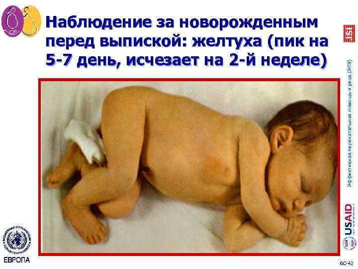 Эффективная перинатальная помощь и уход (ЭПУ) Наблюдение за новорожденным перед выпиской: желтуха (пик на