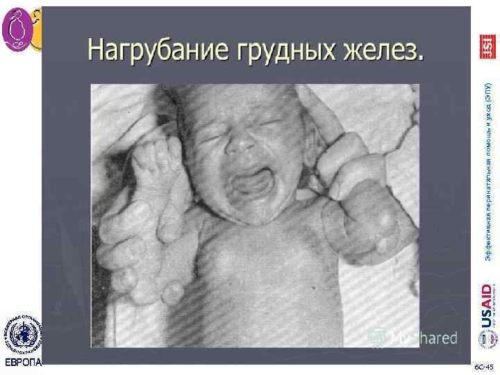 6 C 45 Эффективная перинатальная помощь и уход (ЭПУ) 