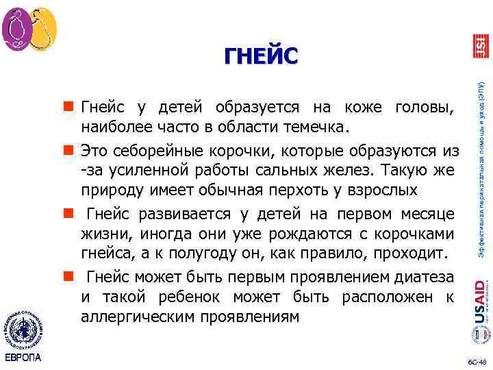 n Гнейс у детей образуется на коже головы, наиболее часто в области темечка. n