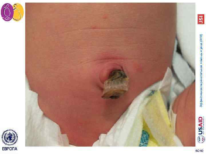 6 C 60 Эффективная перинатальная помощь и уход (ЭПУ) 