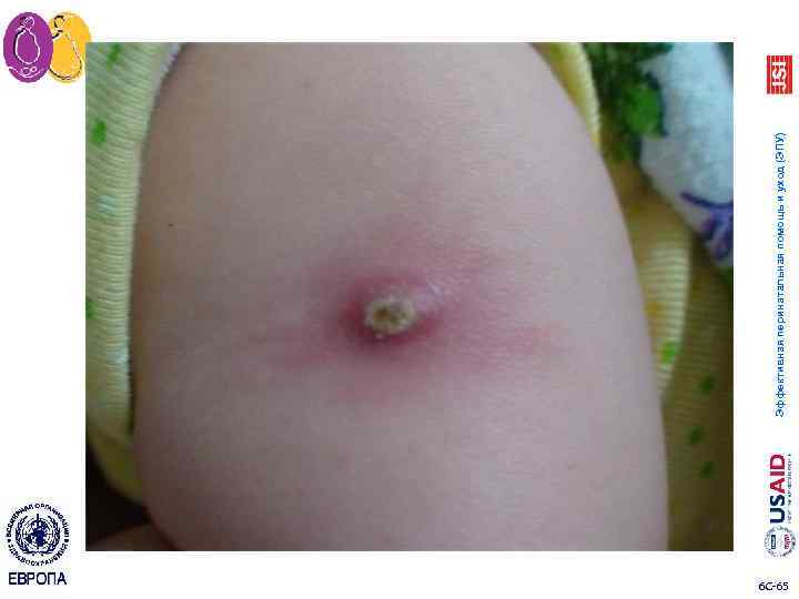 6 C 65 Эффективная перинатальная помощь и уход (ЭПУ) 