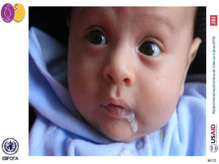 6 C 72 Эффективная перинатальная помощь и уход (ЭПУ) 