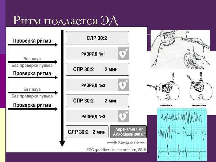 Ритм поддается ЭД 