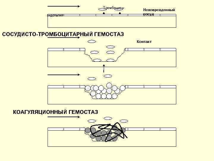 Тромбоциты эндотелий Неповрежденный сосуд СОСУДИСТО-ТРОМБОЦИТАРНЫЙ ГЕМОСТАЗ Контакт КОАГУЛЯЦИОННЫЙ ГЕМОСТАЗ 