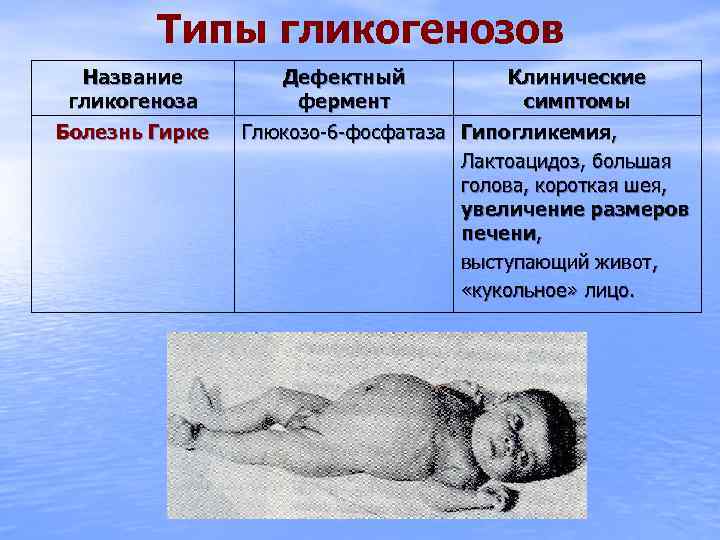 Типы гликогенозов Название гликогеноза Болезнь Гирке Дефектный фермент Клинические симптомы Глюкозо-6 -фосфатаза Гипогликемия, Лактоацидоз,