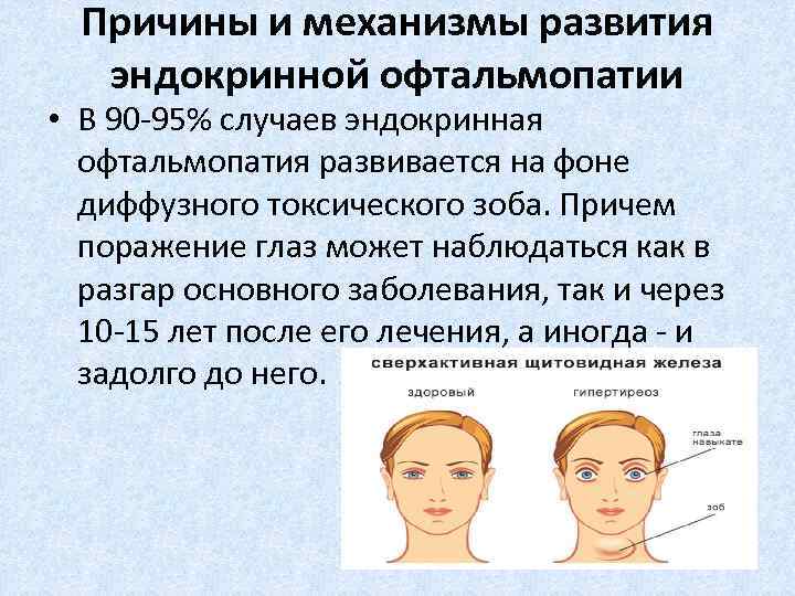 Причины и механизмы развития эндокринной офтальмопатии • В 90 -95% случаев эндокринная офтальмопатия развивается