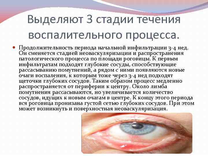 Выделяют 3 стадии течения воспалительного процесса. Продолжительность периода начальной инфильтрации 3 4 нед. Он