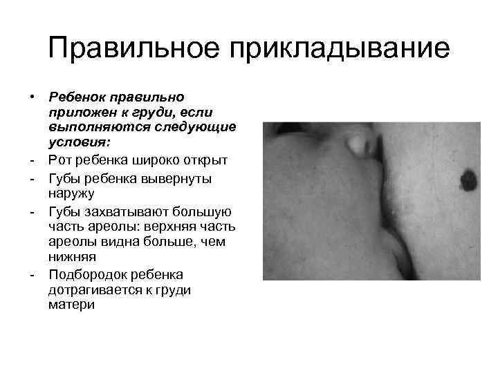 Правильное прикладывание • Ребенок правильно приложен к груди, если выполняются следующие условия: - Рот