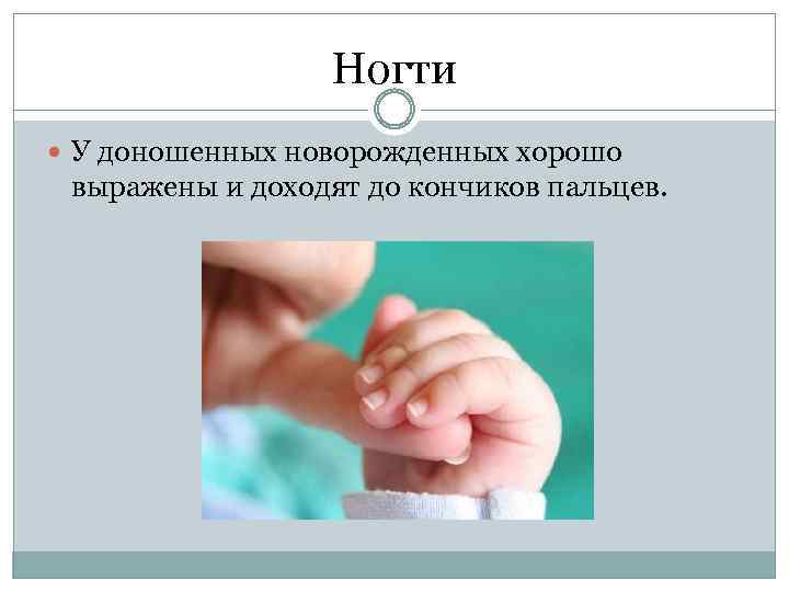 Ногти У доношенных новорожденных хорошо выражены и доходят до кончиков пальцев. 