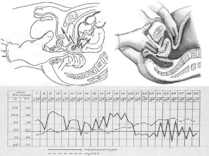Клиническая картина 