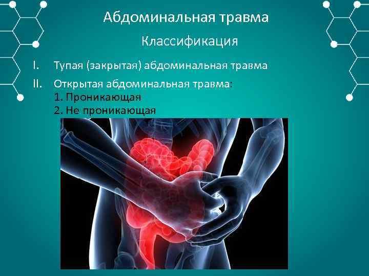 Абдоминальная травма Классификация I. Тупая (закрытая) абдоминальная травма II. Открытая абдоминальная травма: 1. Проникающая