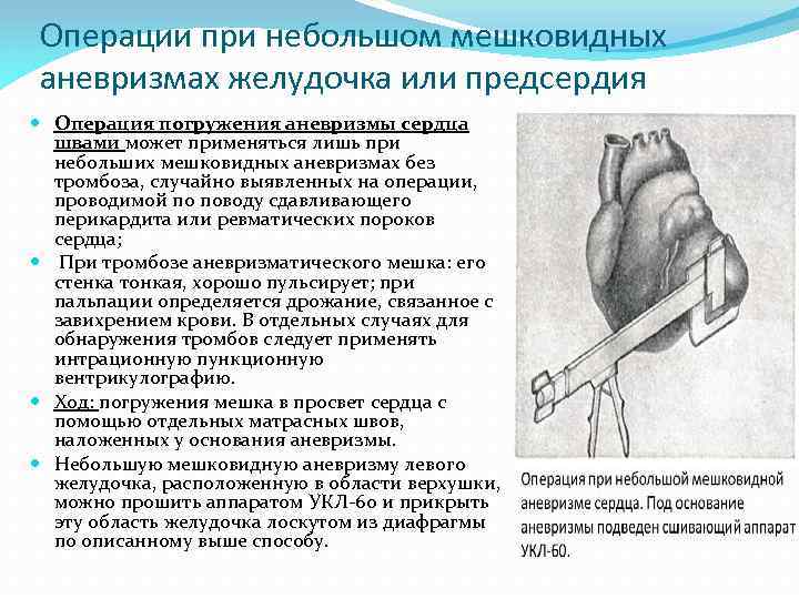 Операции при небольшом мешковидных аневризмах желудочка или предсердия Операция погружения аневризмы сердца швами может