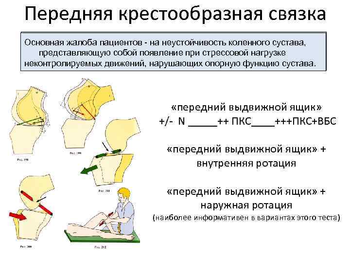 Передняя крестообразная связка Основная жалоба пациентов - на неустойчивость коленного сустава, представляющую собой появление