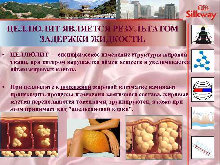 ЦЕЛЛЮЛИТ ЯВЛЯЕТСЯ РЕЗУЛЬТАТОМ ЗАДЕРЖКИ ЖИДКОСТИ. • ЦЕЛЛЮЛИТ — специфическое изменение структуры жировой ткани, при