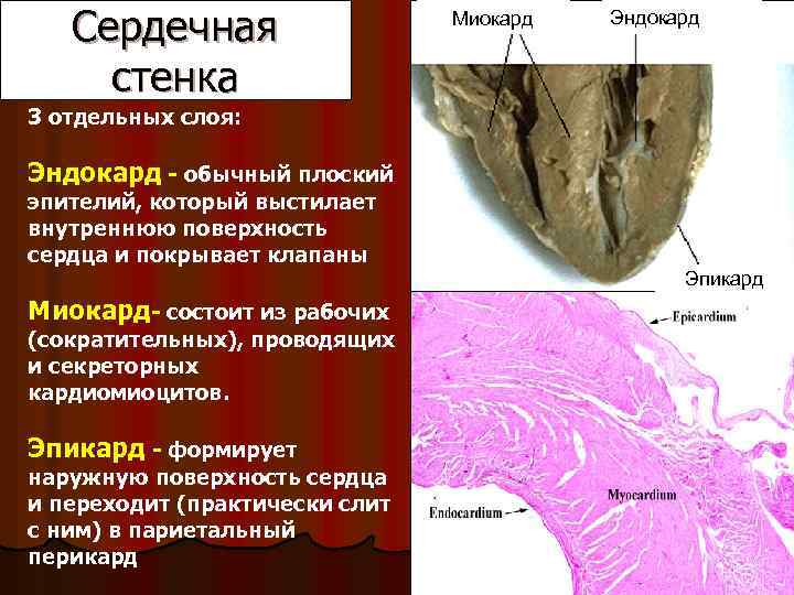 Сердечная стенка Миокард Эндокард 3 отдельных слоя: Эндокард - обычный плоский эпителий, который выстилает
