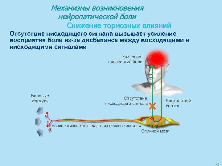 Механизмы возникновения нейропатической боли Снижение тормозных влияний Отсутствие нисходящего сигнала вызывает усиление восприятия боли
